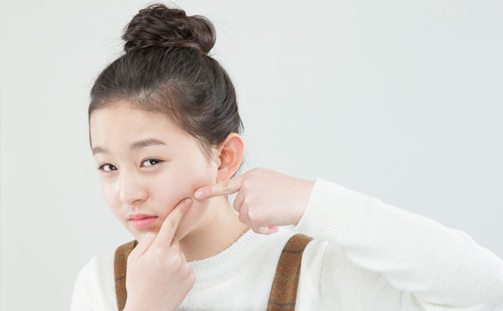사춘기 여드름