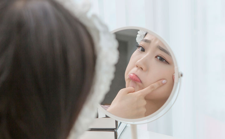 초기 · 비염증성 여드름